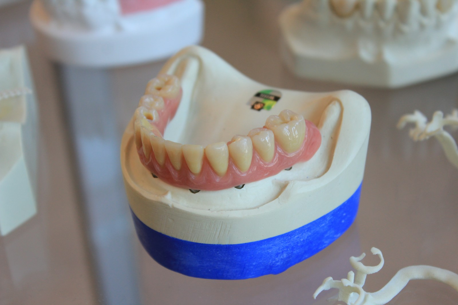 Custom denture set displayed in a dental lab setting